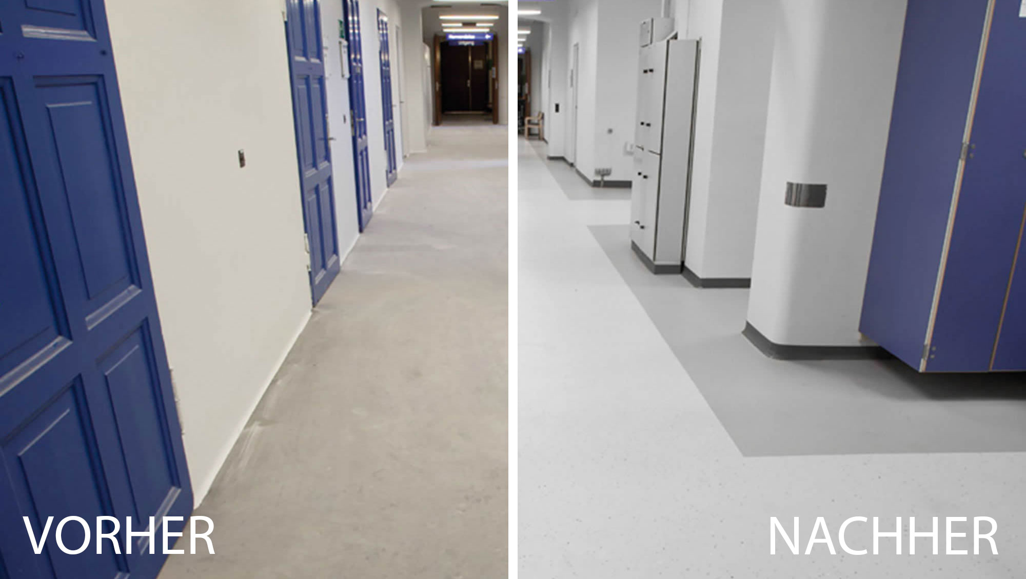 Vorher-Nachher-Vergleich eines Krankenhausflurs mit saniertem Bodenbelag in hellen Grautönen. Das Bild zeigt Bodenbelagsarbeiten mit Dr. Schutz zur Aufarbeitung und optischen Aufwertung eines stark genutzten Flurbereichs.